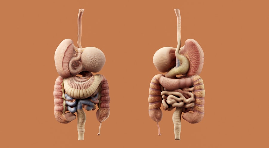 Photo digestive problems